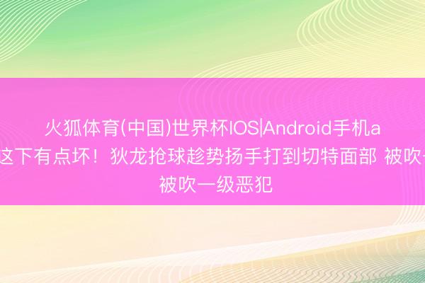 火狐体育(中国)世界杯IOS|Android手机app下载 这下有点坏！狄龙抢球趁势扬手打到切特面部 被吹一级恶犯
